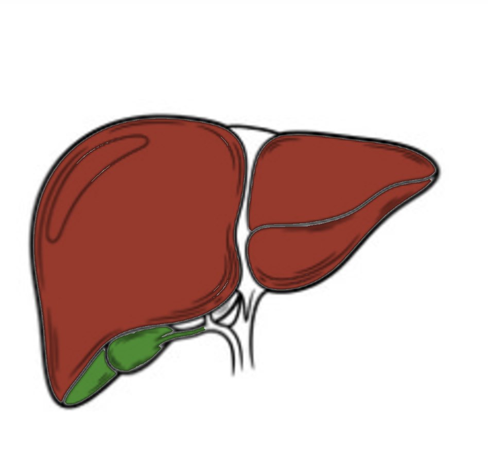 Cáncer de hígado