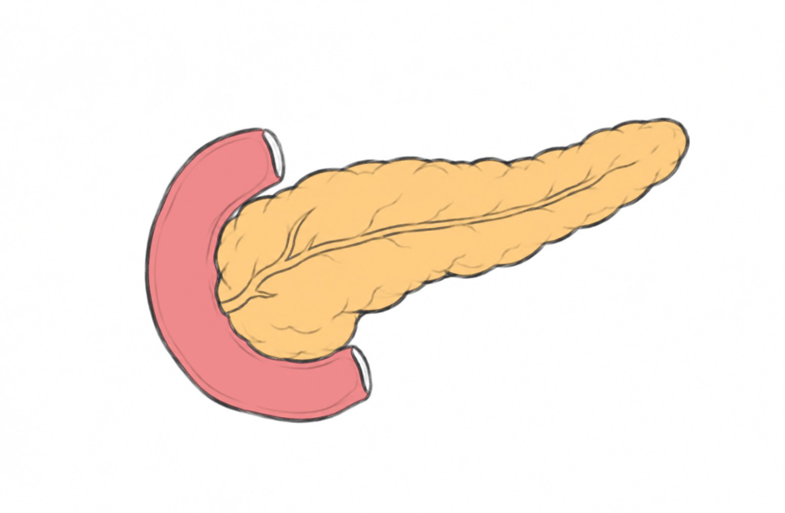 Cáncer de páncreas